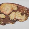 Un foie (malade)